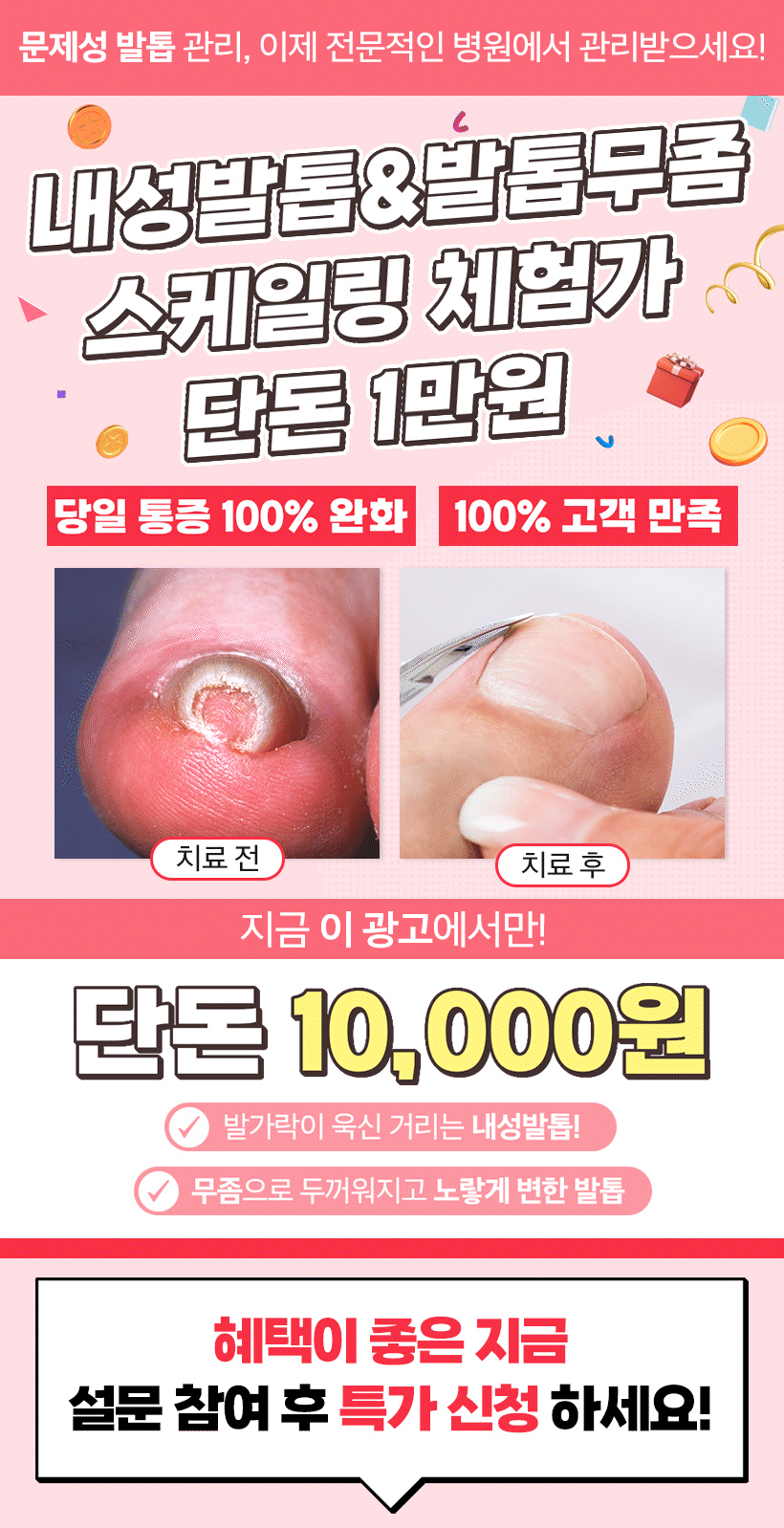 문제성발톱 이벤트 이미지