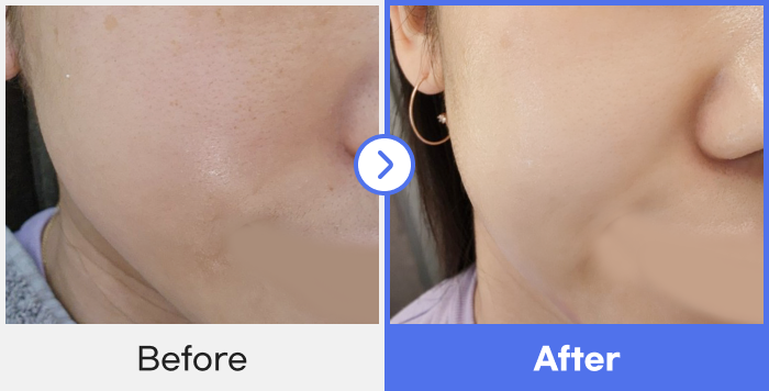 before-after-1}