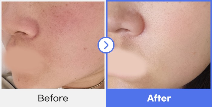 before-after-2}