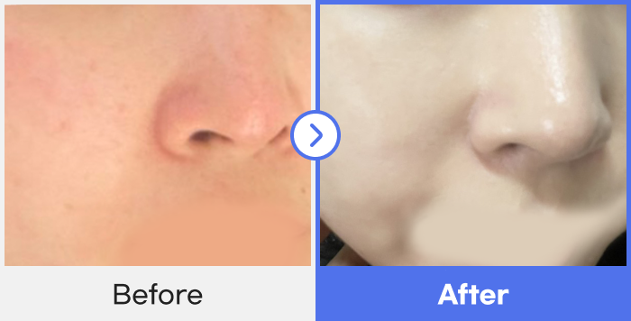before-after-3}