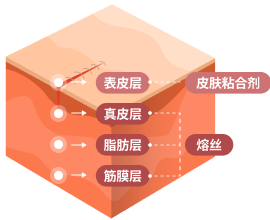 skin layer