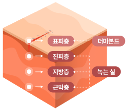 skin layer