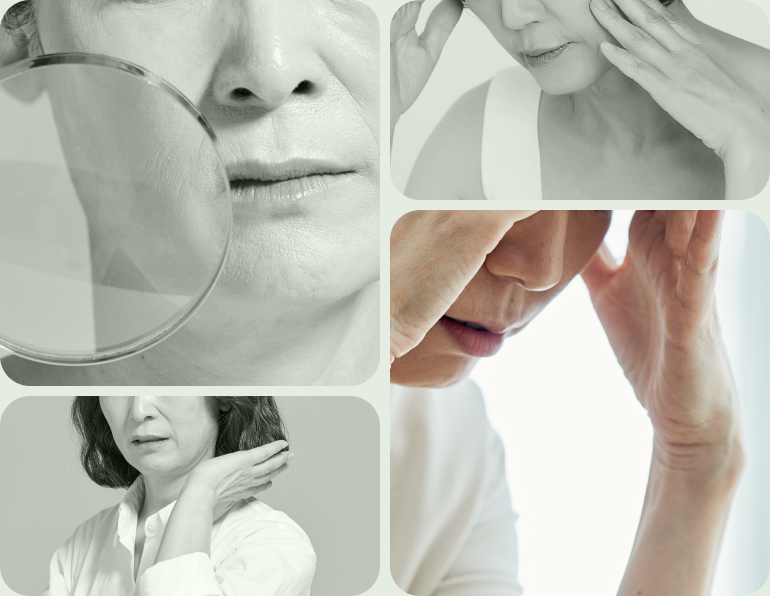 face-lifting-grid