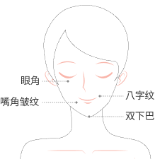 recommended part image